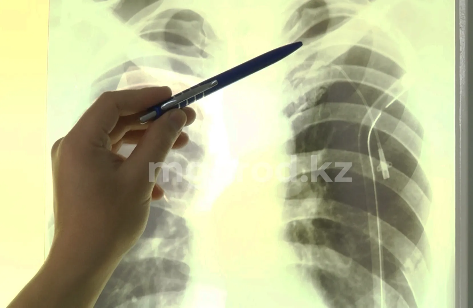 В Уральске подследственный проглотил  инородный предмет