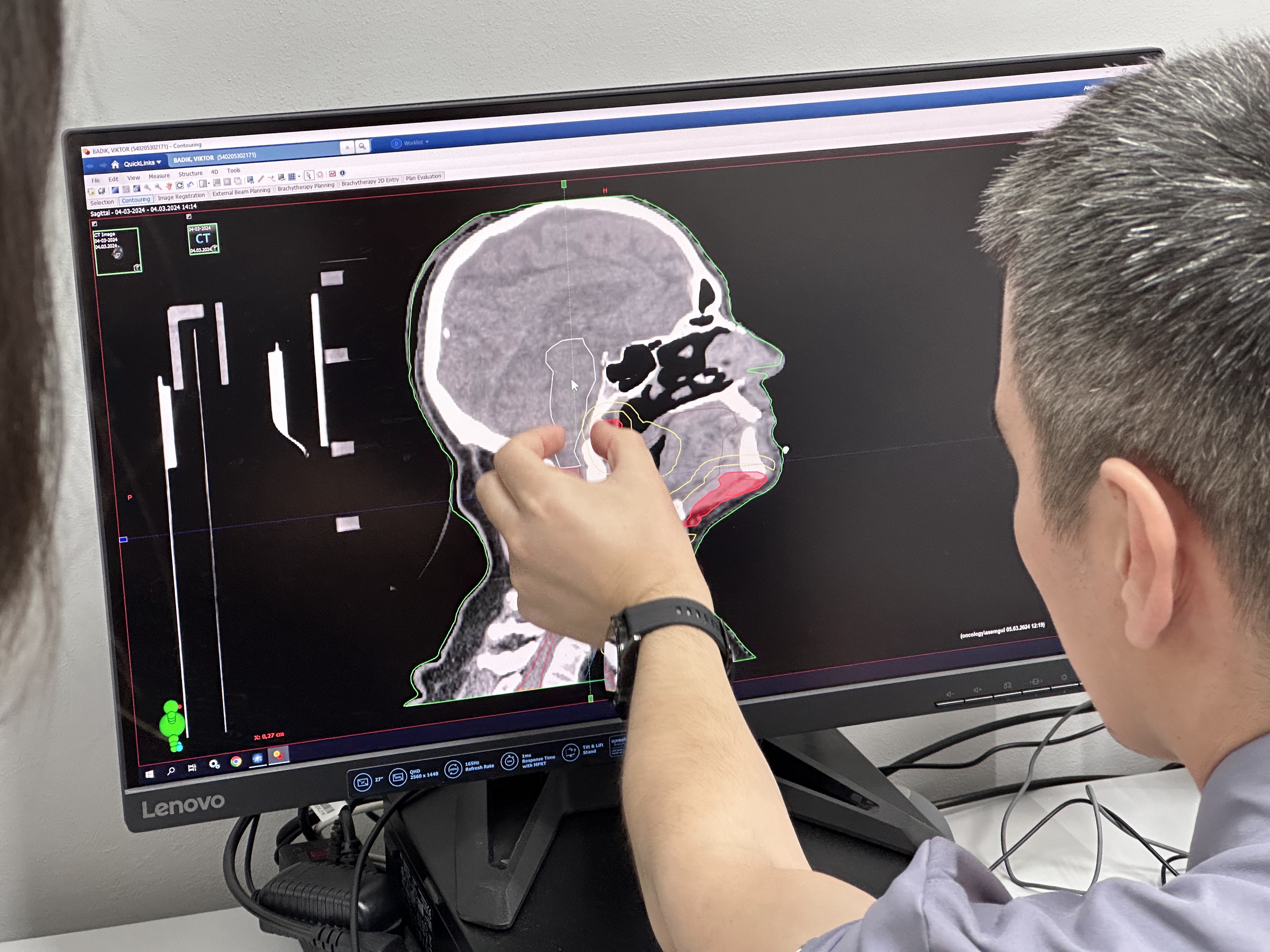Лучевое лечение при злокачественных новообразованиях предлагает центр ядерной медицины «MIG Qazaqstan» в Уральске