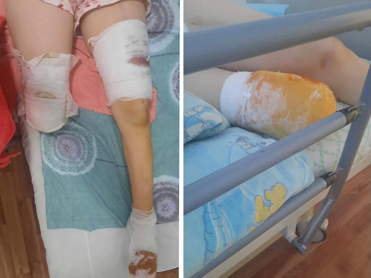 Девочку из Уральска переехал тепловоз. Ей ампутировали ногу.