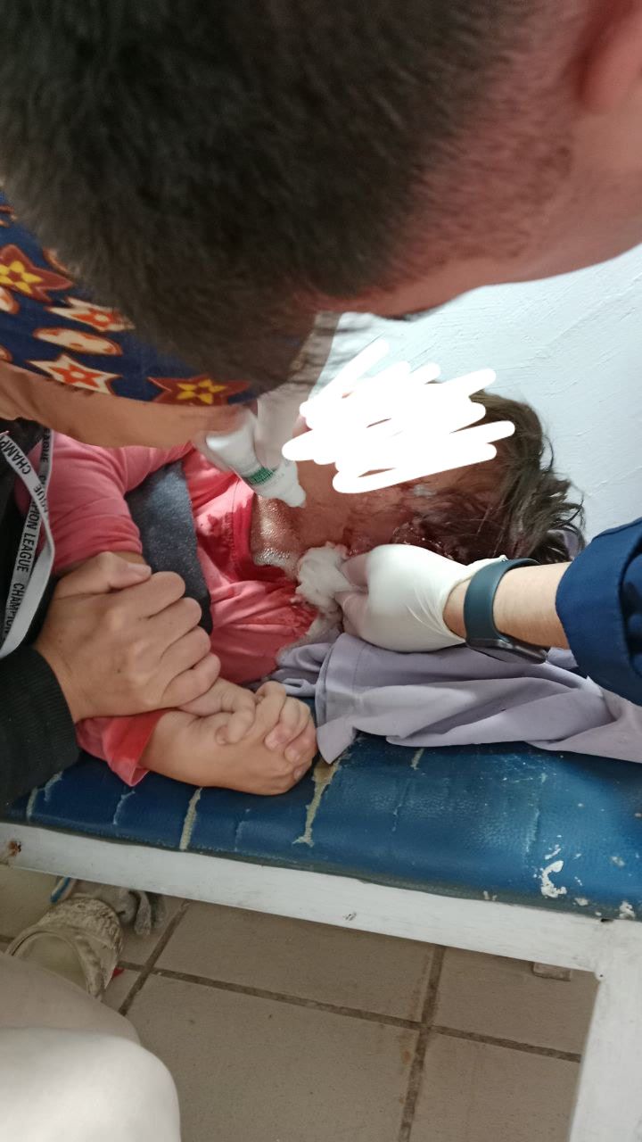 Собаки напали на пятилетнего ребенка в Бурлинском районе