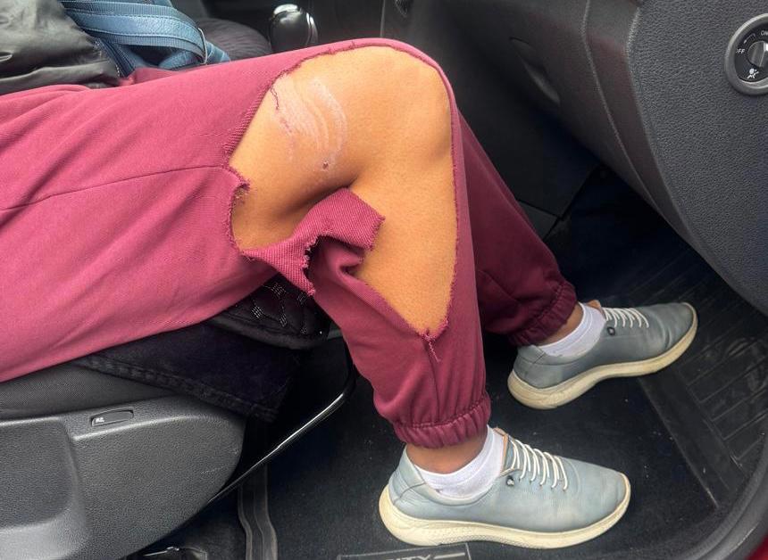 &quot;Она просто вернулась и укусила&quot;: на жительницу Уральска напала бродячая собака