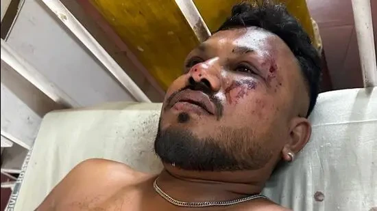 Авиакатастрофа в Индии: выжил один пассажир из 242