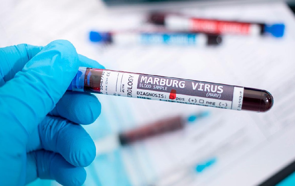 Вирус Марбург: ВОЗ заявила об угрозе новой глобальной эпидемии
