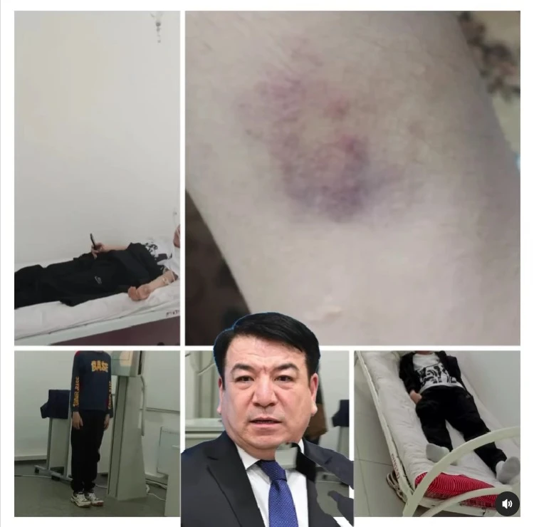 Подростка жестоко избили одноклассники в Атырауской области