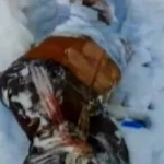 Операция мальчика без уха из Уральска может сорваться из-за нехватки денег