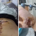 Житель Уральска получил огнестрельное ранение у себя во дворе