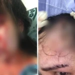 Жительница Атырау обвинила бывшего мужа-депутата в избиениях