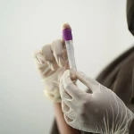 Из-за угрозы распространения сибирской язвы закрыли рынок в Атырау