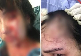 Жительница Атырау обвинила бывшего мужа-депутата в избиениях