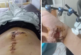 Житель Уральска получил огнестрельное ранение у себя во дворе