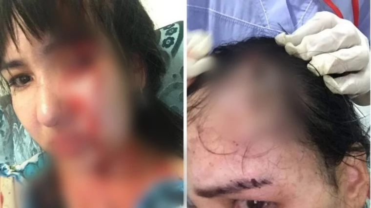 Жительница Атырау обвинила бывшего мужа-депутата в избиениях | Мой Город Жительница Атырау обвинила бывшего мужа-депутата в побоях