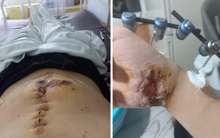 Житель Уральска получил огнестрельное ранение у себя во дворе | Мой Город Житель Уральска получил огнестрельное ранение у себя во дворе